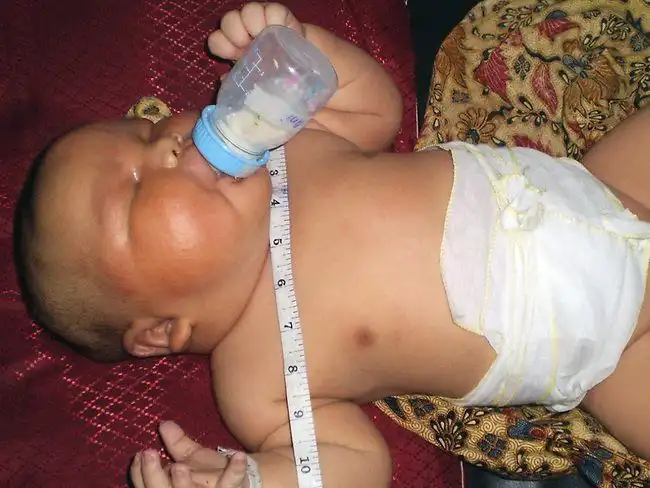 Самые крупные младенцы, из когда-либо родившихся