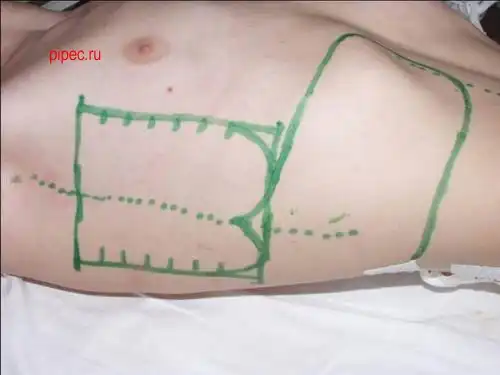 Нет .уя сделают умельцы)))