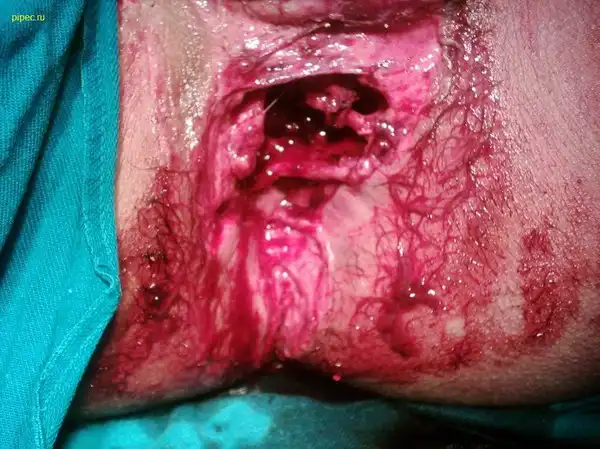 Жесть нах сами смотрите я не стал смотреть