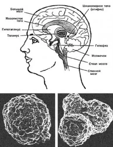 Песок в мозге (как говорят сейчас - много букав, но интересно)