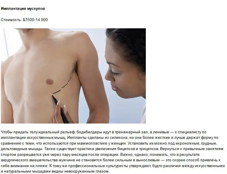 Самые необычные пластические операции