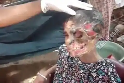 Живой труп.