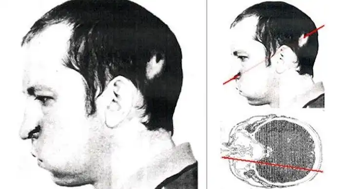 Засунул голову в ускоритель частиц