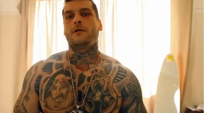 Пугающие модификации тела польского рэпера