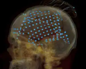 Ученые впервые расшифровали произвольные слова в мозге