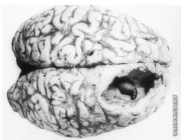 Овод. Паразитирующая личинка.