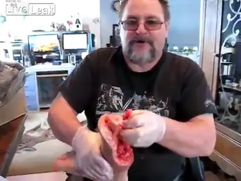 Мужик показывает ампутированную ногу