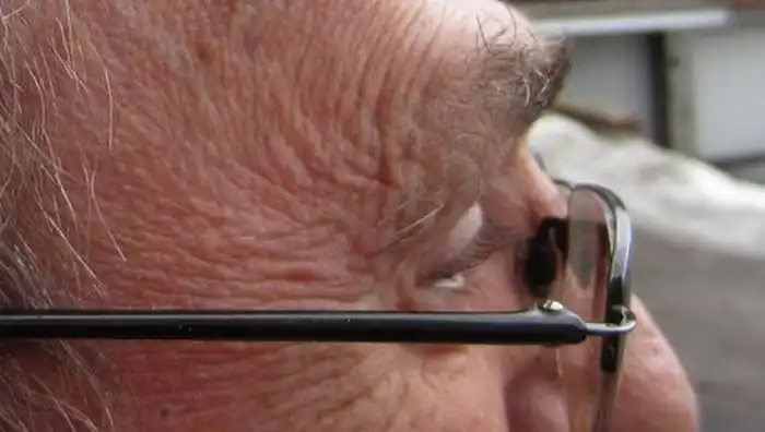 Уцелел после драки