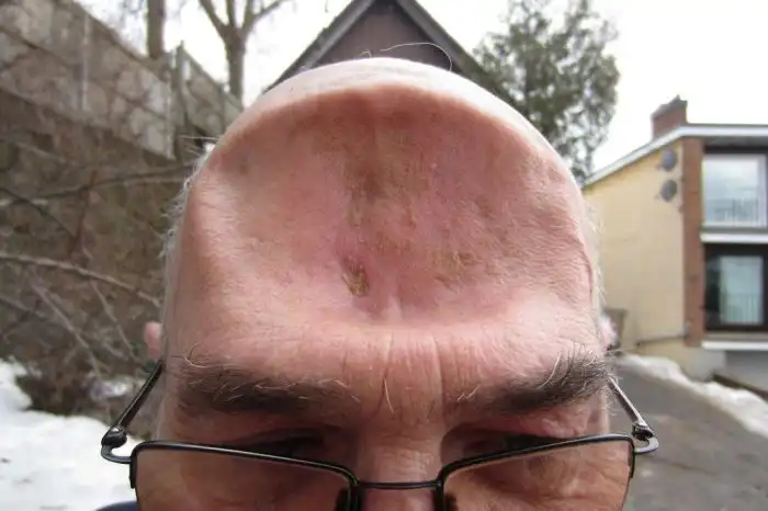 Уцелел после драки