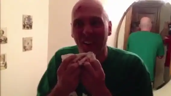 Рану в голове зашили степлером...