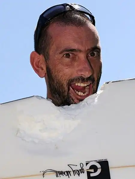 Ужасный шрам от укуса акулы