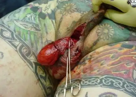 Пост страха и боли by Norwegian Maniac v 2.1