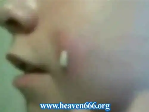 Большая подборка прыщиков!