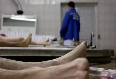 Из жизни патологоанатомов