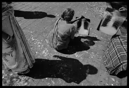 Фотографии больных туберкулезом.