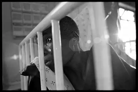 Фотографии больных туберкулезом.