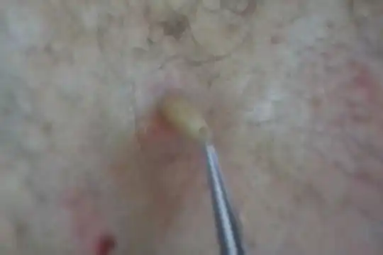 Достают личинки овода...