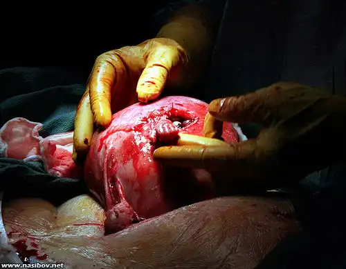 Рука надежды - 7 лет спустя