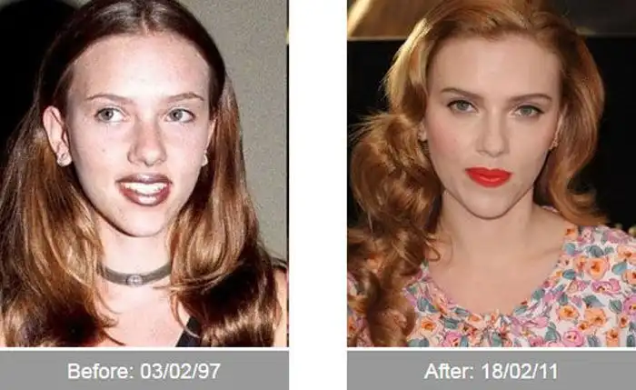 До и после изменения