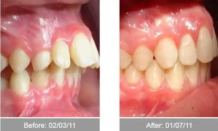 До и после изменения