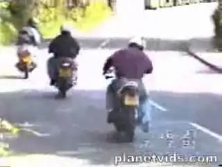 Падения, травмы, переломы...