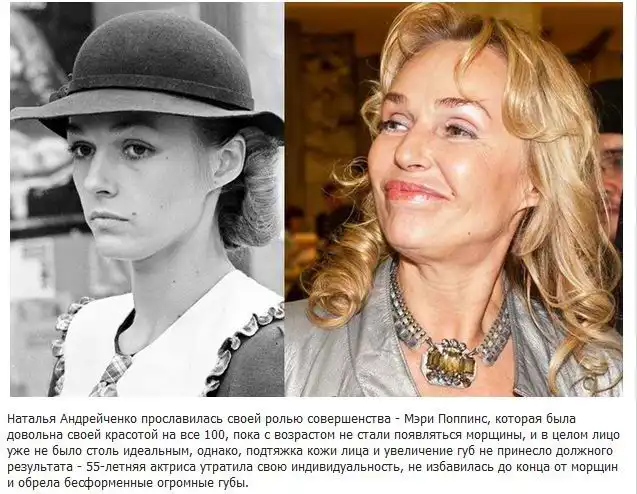 Самые неудачные пластические операции знаменитостей