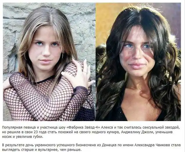 Самые неудачные пластические операции знаменитостей