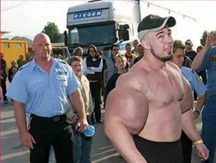 Неудачные пластические операции