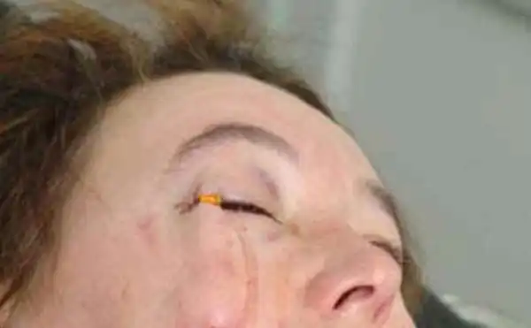 Водителю не стоит носить карандаш в нагрудном кармане