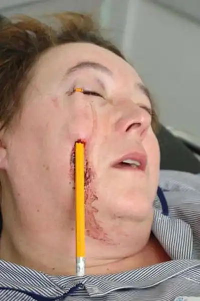 Водителю не стоит носить карандаш в нагрудном кармане