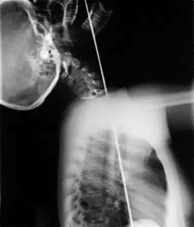 Шпагоглотатели