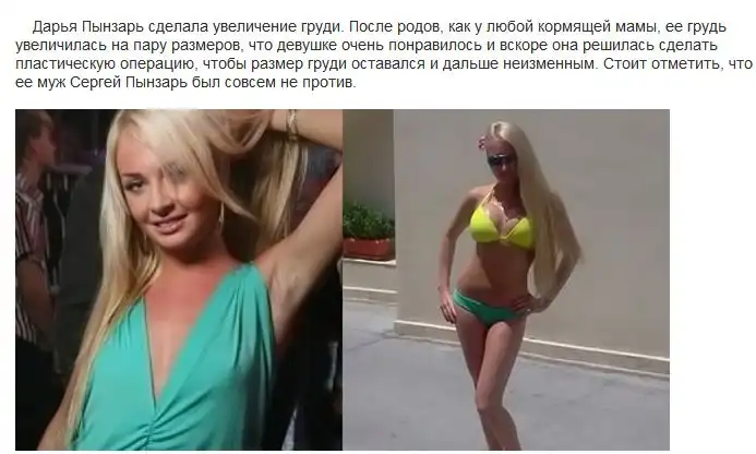 До и после пластических операций на "Дом-2"