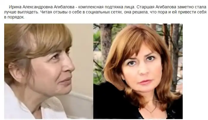 До и после пластических операций на "Дом-2"