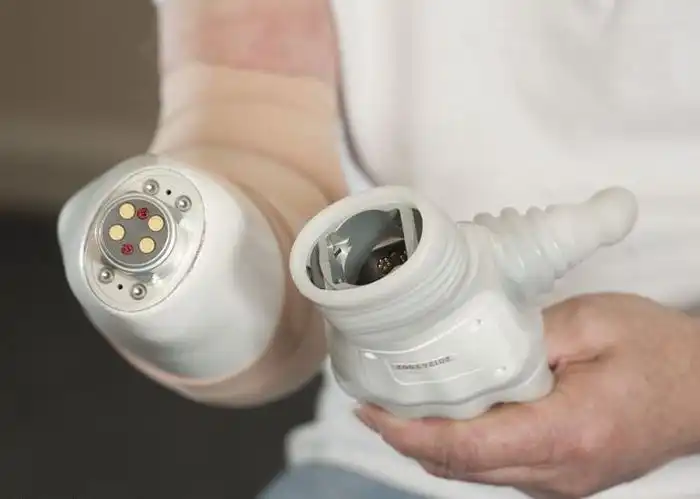 Бионические конечности способны заменить поврежденные руки и ноги