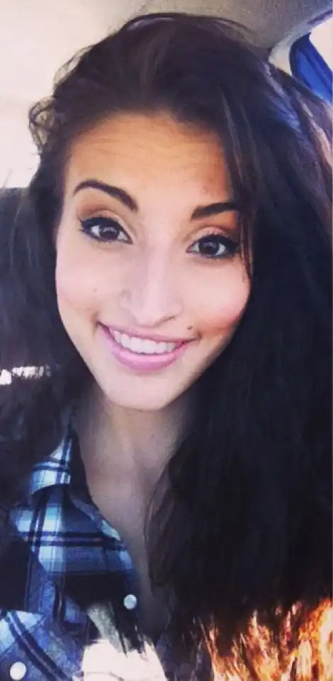 Как изменилась девушка после операции на челюсти