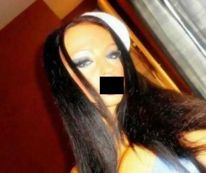 Жертвы пластической хирургии