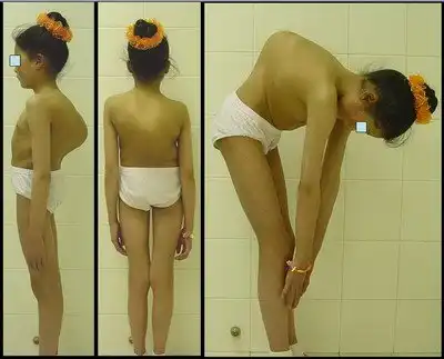 Береги спину смолоду - сиди за партой правильно