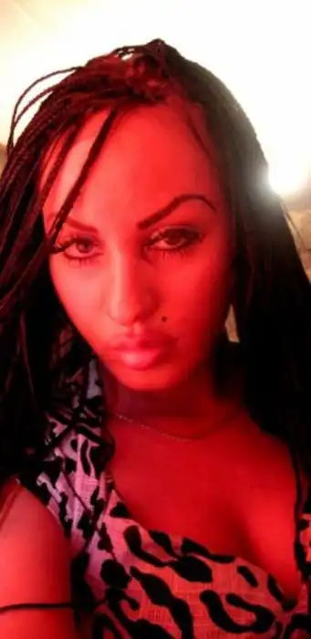 Алена Пискун - жертва пластической хирургии