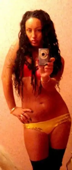 Алена Пискун - жертва пластической хирургии