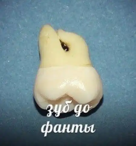 ТОП-10 напитков, которые разрушают наши зубы