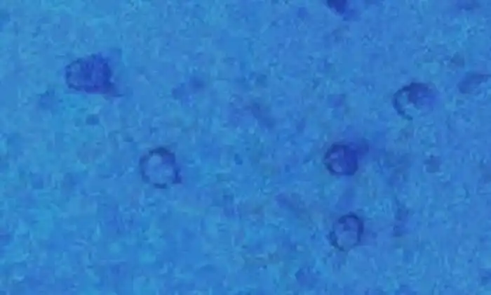 Аномалии океанских глубин