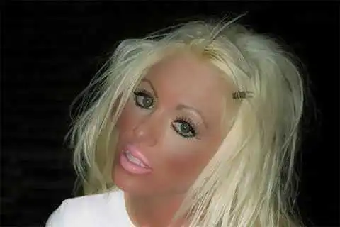 Я не могу перестать загорать