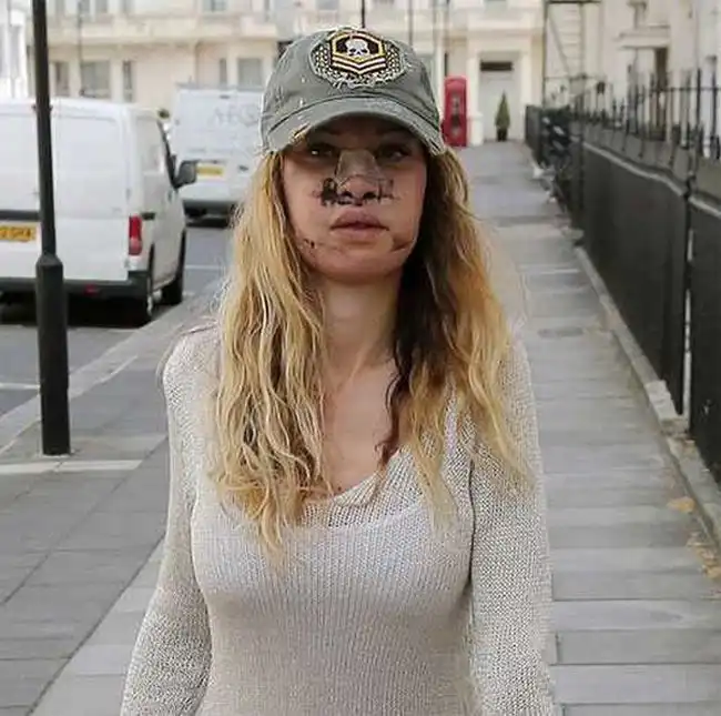 Алисия Дюваль решила заново корректировать свою внешность