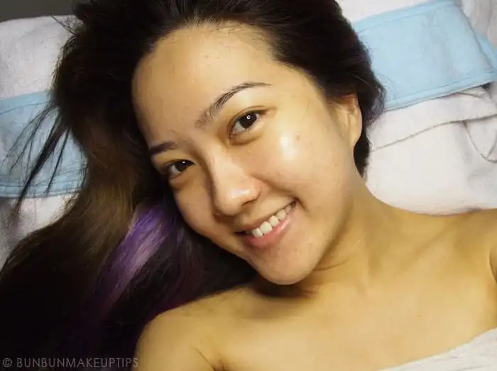 Массаж лица изуродовал девушку