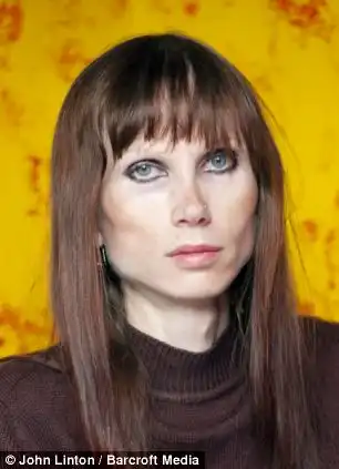 Анорексия превратил меня в старушку