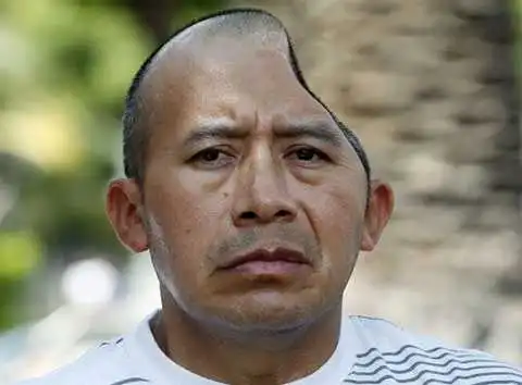 Его череп как пирог от которого отрезали четверть