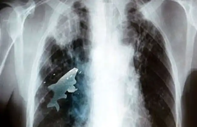 10 людей, внутри которых кто-то жил