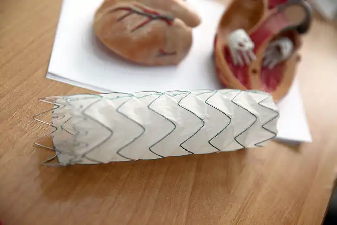 Дела сердечные, или операция без распилов