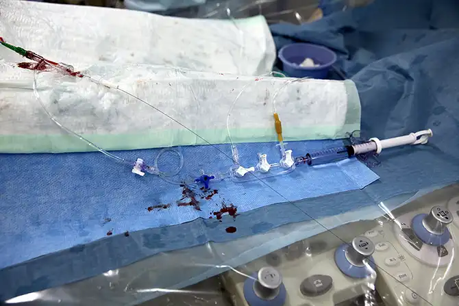 Дела сердечные, или операция без распилов