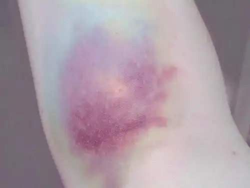 Запретная страсть. Последствия...